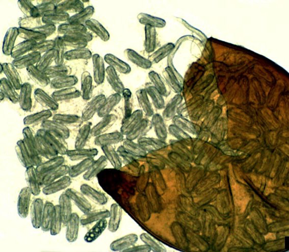 Globodera rostochiensis